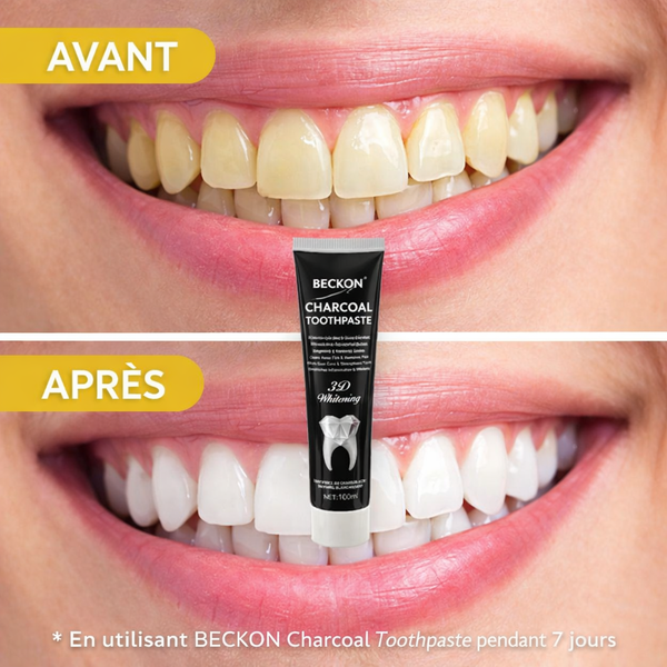 📦 BECKON CHARCOAL – Dentifrice au Charbon Actif 3D Whitening